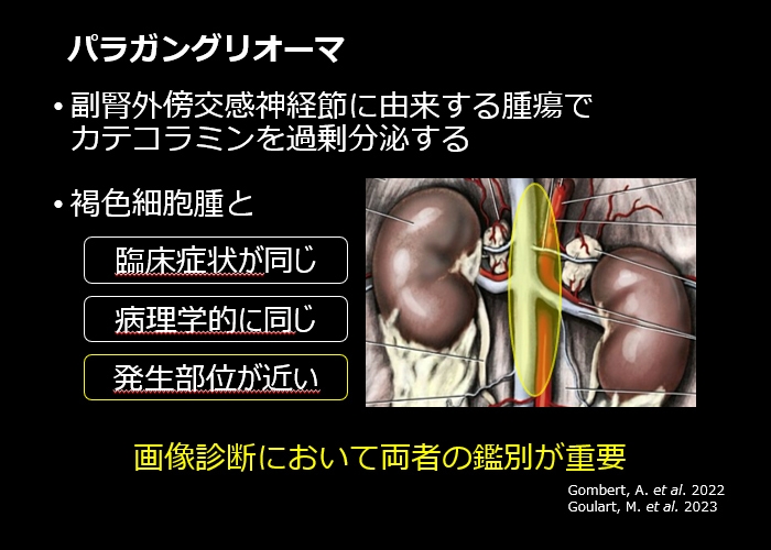 腹腔内出血を認めたパラガングリオーマの犬の一例